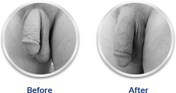 Erecto Gold Capsule!