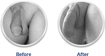 Erecto Gold Capsule!