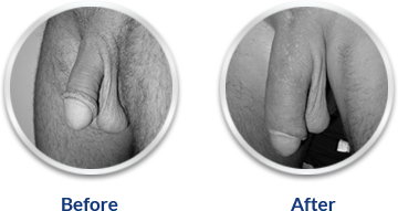 Erecto Gold Capsule!